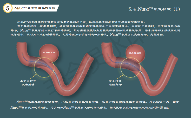 泰杰偉業(yè)公司動(dòng)脈栓塞裝置系統(tǒng)使用手冊(cè)設(shè)計(jì)圖11