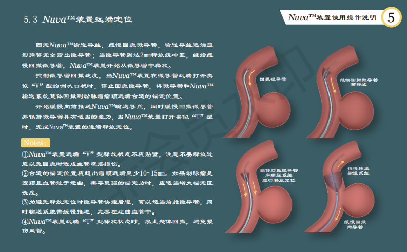 泰杰偉業(yè)公司動(dòng)脈栓塞裝置系統(tǒng)使用手冊(cè)設(shè)計(jì)圖10