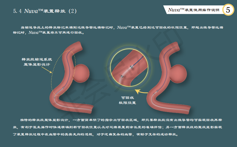 泰杰偉業(yè)公司動(dòng)脈栓塞裝置系統(tǒng)使用手冊(cè)設(shè)計(jì)圖12