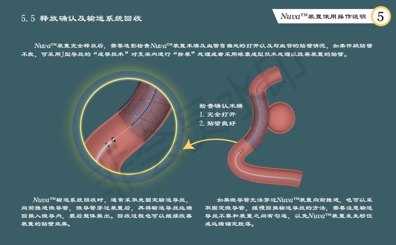 泰杰偉業(yè)公司動(dòng)脈栓塞裝置系統(tǒng)使用手冊(cè)設(shè)計(jì)圖14