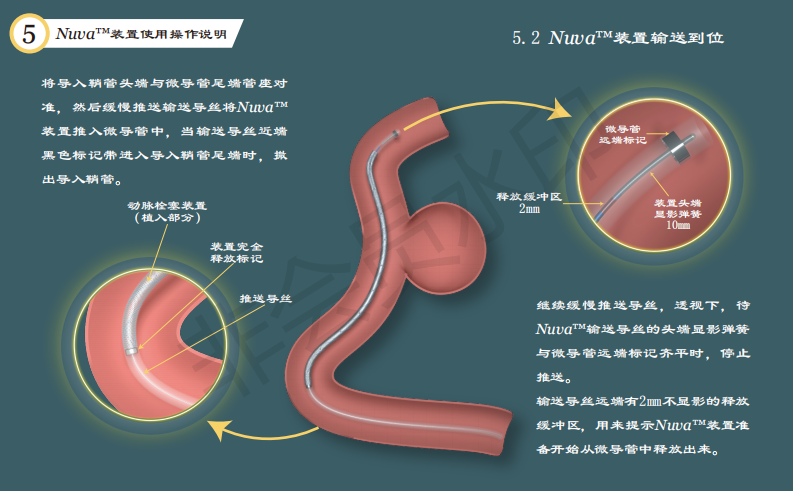 泰杰偉業(yè)公司動(dòng)脈栓塞裝置系統(tǒng)使用手冊(cè)設(shè)計(jì)圖9