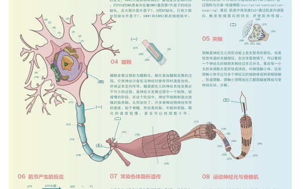 脊髓性肌萎縮癥